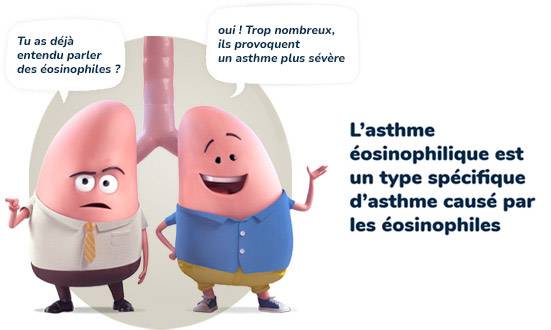 asthme-a-eosinophile_severe L'asthme Eosinophile sévére